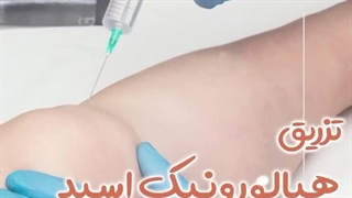 تزریق هیالورونیک اسید برای آرتریت زانو | دکتر طاهریان