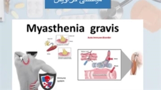 کاردرمانی جسمی