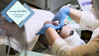 مراحل پاکسازی پوست کلینیک سلامت منافذ باز پوست
