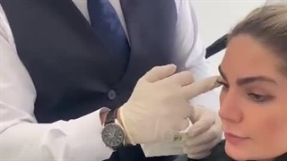 فیلم تزریق بوتاکس + توضیحات از زبان پزشک