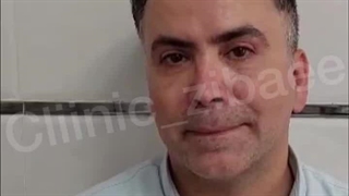 جراحی پلک بالا و پایین در کلینیک آرتین