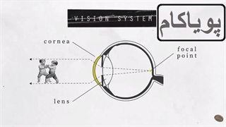 از لیزیک چه می‌دانید؟