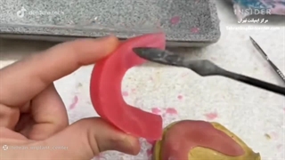 نخوه ساخت دندان مصنوعی با زیرنویس فارسی - مرکز تخصصی ایمپلنت تهران