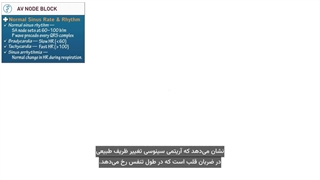 A.V NODE BLOCK