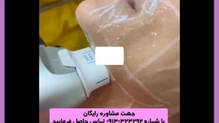 هایفوتراپی کشیدن دندان