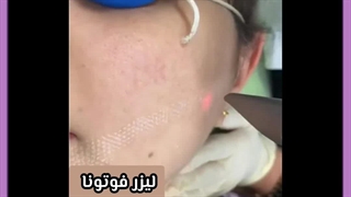 بهترین مرکز لیزر فوتونا دکتر پوست