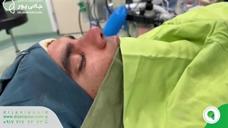 جراحی بینی گوشتی با پوست ضخیم، نیمه فانتزی | دکتر مسعود جانی پور