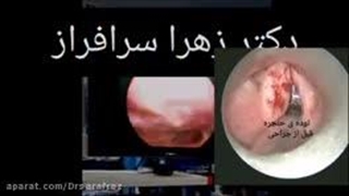 فوق تخصص حنجره و جراح سر و گردن در تهران، دکتر زهرا سرافراز