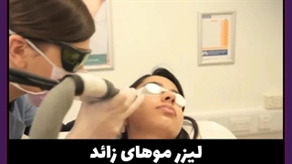 لیزر موهای زائد جراحی فک