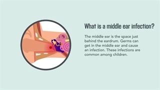 عفونت گوش میانی در کودکان