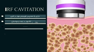 معرفی و ویژگی های دستگاه لاغری آر اف کویتیشن