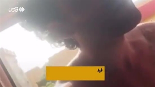 صادقی لیزر مو