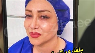 بلفاروپلاستی پلک بالا و پایین در کلینیک آرتین