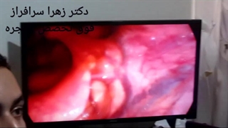 فوق تخصص حنجره در تهران ، دکتر زهرا سرافراز