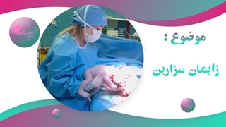 1زایمان سزارین