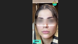 نمونه کار لب