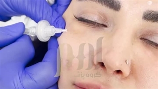 کربوکسی تراپی زیر چشم روکش دندان