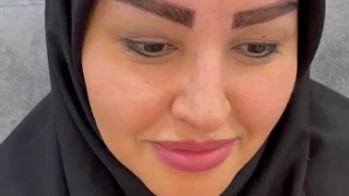 برترین کلینیک کاشت ابرو در تهران |پارمیدا