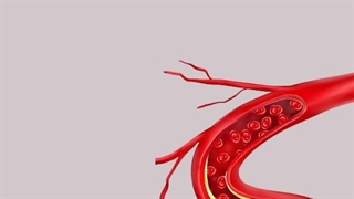 نحوه تشخیص چربی خون بالا