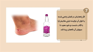 تاول پا و پیاده روی اربعین