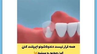 دندان مصنوعی