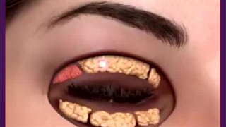 بهترین جراح پف چشم تهران