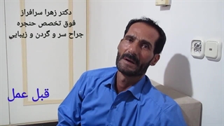 متخصص خوب حنجره در تهران، دکتر زهرا سرافراز