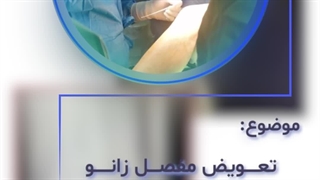 تعویض مفصل زانو