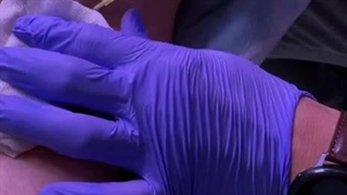 تزریق بوتاکس زیر بغل (بوتاکس تعریق)