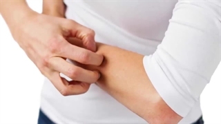 چجوری خارش بدن را درمان کنیم ؟