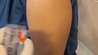 تزریق واکسن گارداسیل