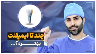 چند تا ایمپلنت بکارم بهتره