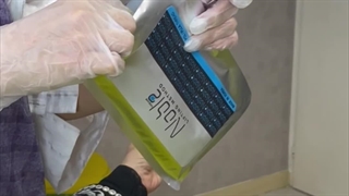 لیفت صورت با نخ توسط دکتر نبی پور